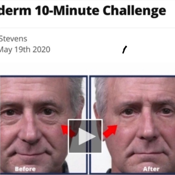 Fast Acting Eye Serum, Tint & Tighten (5) - Picture 5 of 15